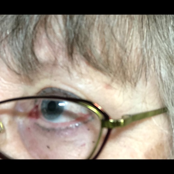 Eyeglasses - Picture 2 of 13
